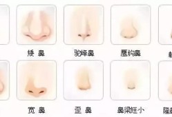 胎儿鼻低平（狮子鼻和猪鼻子区别）