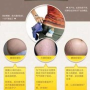 孕妇长妊娠纹了怎么办？有什么方法可以消除,孕期妊娠纹如何消除最快