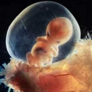 4个月胎儿在肚子里图片（四个月胎儿在肚子里的图片）