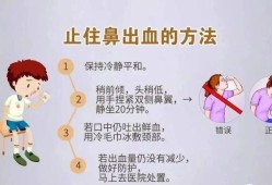 怀孕期间流鼻血是怎么回事（孕妇经常流鼻血是怎么回事）