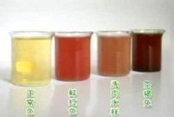 孕期尿偏红色是怎么回事,孕期尿液偏红什么原因引起的