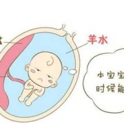孕期羊水多怎么办（孕晚期羊水多怎么办）