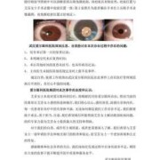 胎儿强光斑意味着什么（胎儿左心室有强光斑是什么意思啊？B超单是这样写的）