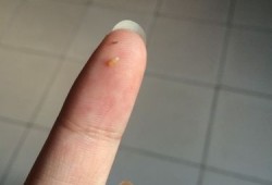 孕期乳头有白点（孕期乳头有白点点怎么回事）