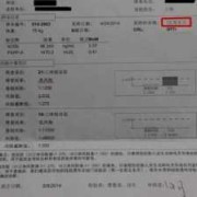 中筛是检查一些什么？跟早筛一样都要检查唐氏吗,孕期早筛是检查什么项目