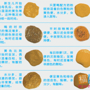孕期排便正常（孕妇一天去3次大便是正常的吗）