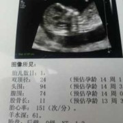 13周胎儿nt图片（13周胎儿的nt标准值）