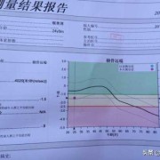 孕期骨质疏松怎么办（孕妇骨密度正常值是多少）