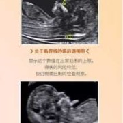 胎儿染色体正常却畸形（胎儿染色体正常却畸形怎么办）