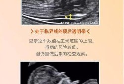 胎儿染色体正常却畸形（胎儿染色体正常却畸形怎么办）