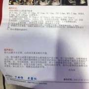 一个胎儿超声心动图检查，必须要做吗,胎儿超声图片