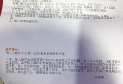 一个胎儿超声心动图检查，必须要做吗,胎儿超声图片