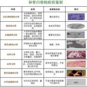 孕期白带发黄正常吗（怀孕初期白带发黄怎么办）