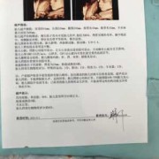 在三维彩超时宝宝缩成一团怎么办,胎儿蜷缩成一团彩超图,孕17周
