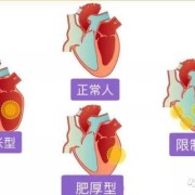 胎儿心肌病（胎儿心肌病）