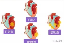 胎儿心肌病（胎儿心肌病）