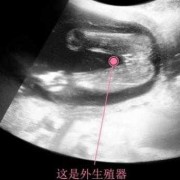 胎儿4个月图片（宝宝4个月脚还是喜欢卷着不伸直正常吗）