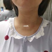 孕期色素沉着多久恢复（孕期色素沉着多久恢复正常）