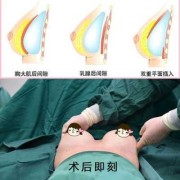 孕期胸部血管明显（乳房上的青色血管很明显是怎么回事呀）