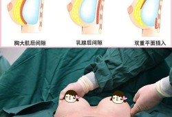 孕期胸部血管明显（乳房上的青色血管很明显是怎么回事呀）