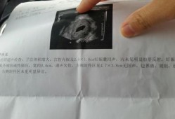 怀孕58天胎儿图片（58天宝宝多久喂一次）