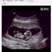 孕期体检时间及项目（怀孕做B超，做两次B超的间隔时间应该是多长）