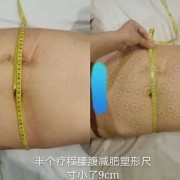孕期塑形（孕期塑形好还是产后塑形）