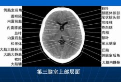 胎儿第三脑室正常值（胎儿第三脑室正常值是3mm还是10mm）