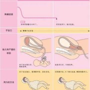 自然分娩胎儿从哪里出来,胎儿分娩的七个步骤示意图