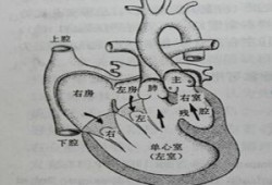 单心房单心室什么意思,胎儿单心室还能生存吗