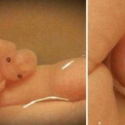 胎儿偏小两周怎么办（孕晚期宝宝偏小两周怎么办）
