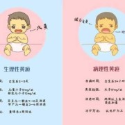 怎样预防刚出生的宝宝有黄疸反应,孕期怎么预防宝宝黄疸高