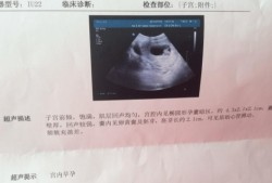 孕期做多少次b超（孕期做多少次b超合适）
