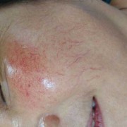 怀孕四个月了流一点血丝是怎么回事,孕期红血丝分泌