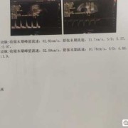 80天是几月龄,胎儿81天还能检查子宫动脉阻力吗