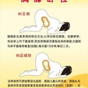 胎儿胎位不正（如何纠正孕妇胎位）