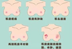 乳头结痂怎么回事,孕期乳头结痂能去掉吗