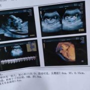 怀孕19周胎儿彩超图（19+周什么意思）