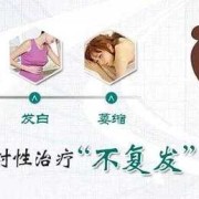 得了外阴白斑需要做手术吗,