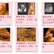四维彩超是检查什么的,四维彩超看胎儿性别图解