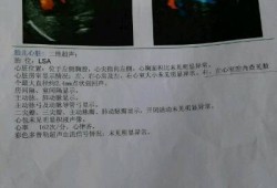 胎儿心脏四维彩超能检查出什么,胎儿心脏彩超检查什么内容