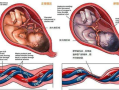 胎儿脐带绕颈原因（孕宝宝脐带绕颈怎么办？脐带绕颈对胎儿有什么坏处）