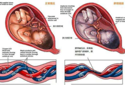 胎儿脐带绕颈原因（孕宝宝脐带绕颈怎么办？脐带绕颈对胎儿有什么坏处）