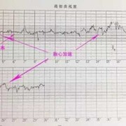 胎儿身体动（做胎心监护宝宝老动一动心率就快正常么）