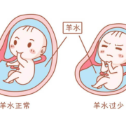 羊水少胎儿缺氧的表现（羊水少胎儿缺氧的表现与症状）