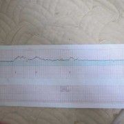 胎儿有心跳了（怀孕几周有胎心，有了胎心就表示胎儿发育很好了吗）