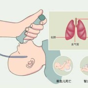 胎儿窒息（胎儿窒息）