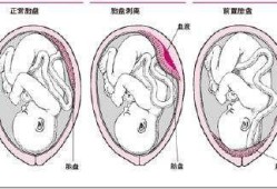 怀孕多久开始长胎盘,胎儿几个月有胎盘和脐带