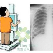 备孕期间能拍胸片吗（教资体检怀孕了可以不做胸透吗）