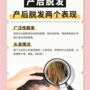 如何防止孕期脱发（如何防止孕期脱发的方法）